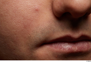 HD Face Skin Raymon Kastor face lips mouth nose skin…